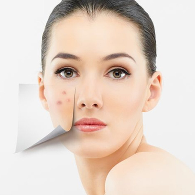  Gel Clean & Clear Advantage Acne Spot Treatment 22ml